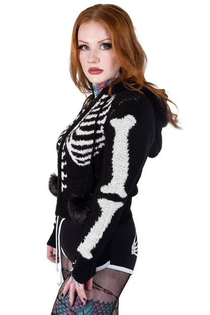 Bony Rib Cage Skeleton Fur Zip Sweater [BLACK/WHITE]